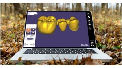 Udemy - Digital Flow in Dentistry and Basic Exocad Program